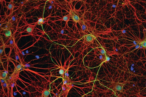 Interlinked Neurons